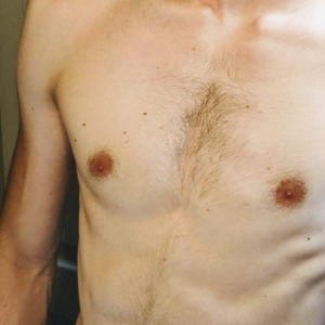 Couplegay26-27ans MYM